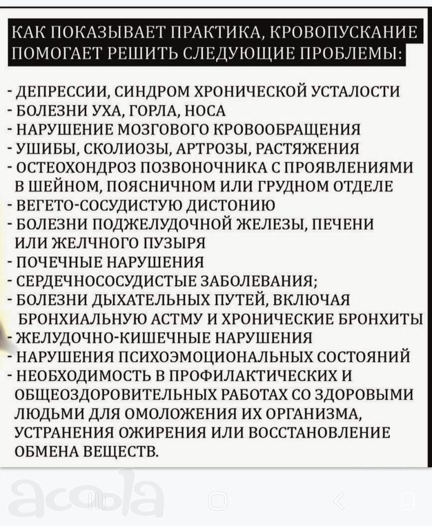 Хиджама, кровопускание